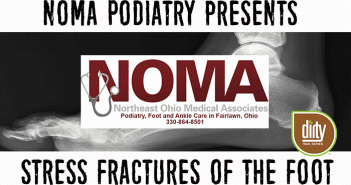 Common Runners’ Injury: Stress Fractures of the Foot